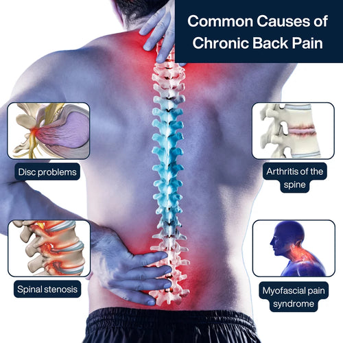 💪 GEL LUMBAR – Alivio inmediato para el dolor de espalda baja