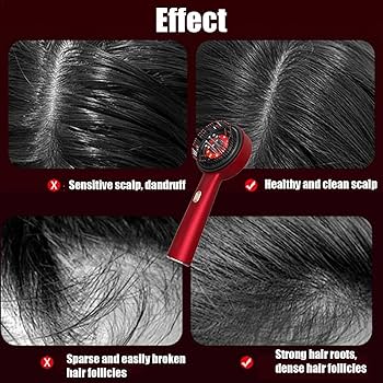 Electric Scalp Massage – Relajación Profunda y Estimulación Capilar
